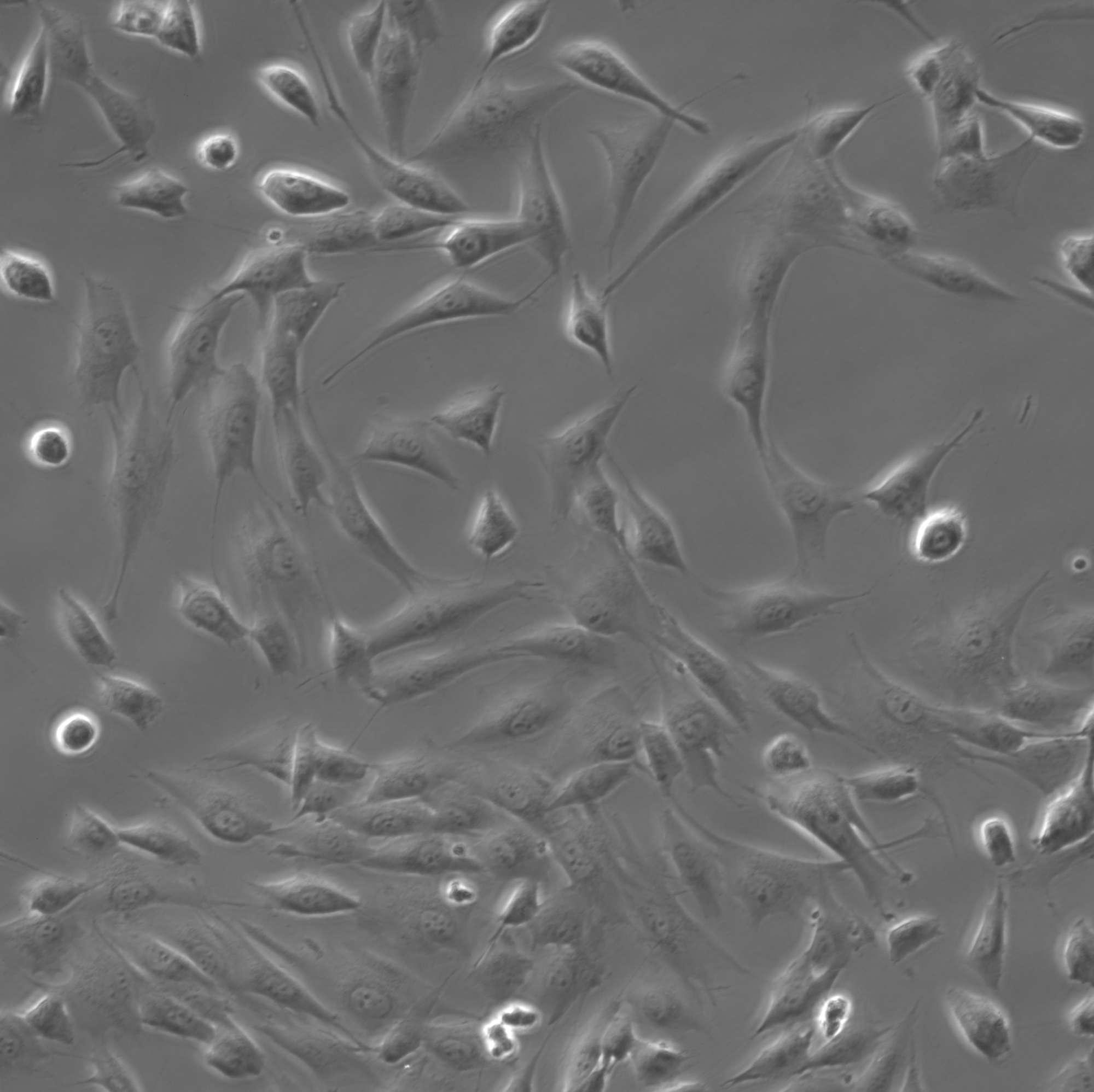 Phase-contrast microscopy of MG-63 cells